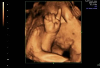 产妇产检做“四维”，胎儿竟在子宫里“数数”