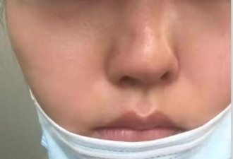 女儿整容失败 母亲割脉：在医院门口讨说法