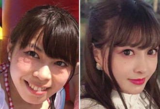 妹子花700万整容成小仙女，如今靠脸月赚50万！