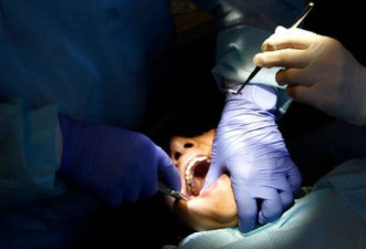加拿大看牙医太贵：有人自己动手拔牙