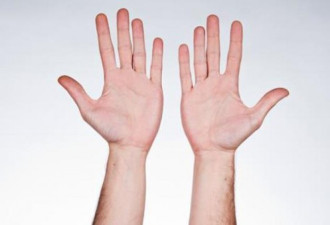 7个能够代表是否健康的征兆，看手就知道