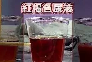 严重或致命！吃了这菜 男童排出酱油尿