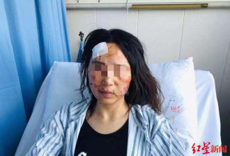中国女子当街被公公丈夫暴打，嘴里灌满了屎