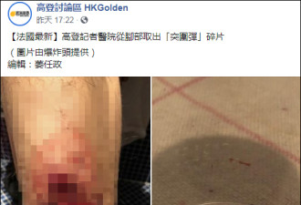 香港记者被法国警察炸伤 记协怎么不谴责？