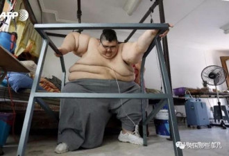 世界最胖男子成功减掉660斤 曾重达半吨多