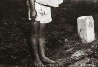 原子弹炸后的照片：男孩背死去的弟弟到火葬场