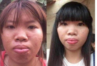 越南“凤姐”为嫁富二代花9万整容却被女儿暴露