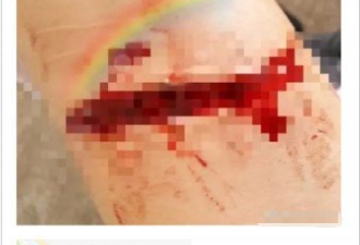 女留学生在微博直播割腕，网友竟刷屏叫她去死