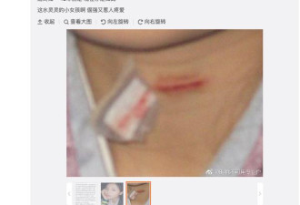 刘涛12年前因拍戏被划伤脖子 血流不止崩溃大哭