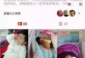 &quot;眼癌女童之死&quot;事件:爷爷将剩余1301元善款捐出