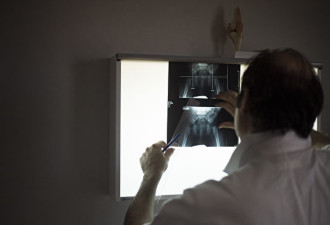 X射线机辐射超标 重庆一医院十多职工患癌