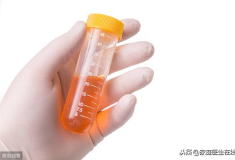 尿液颜色一直很黄？还有这几个可能