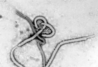 科学家用尽22年 想找出埃博拉隐藏寄主