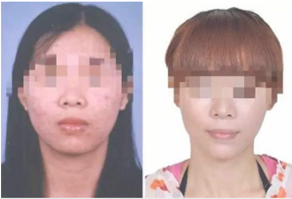 女子挪用公款潜逃16年 整形换脸还是被抓