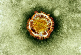 魁省卫生厅：5人或感染新型冠状病毒 曾赴中国