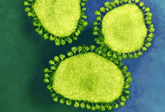 中美科学家5年前曾造出类SARS新冠病毒