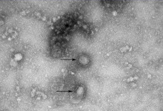 平反？专家：新型冠状病毒属于SARS病毒