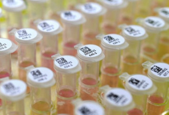 美国CDC承认检测试剂盒有缺陷 已运往多国
