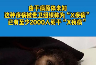 疫情未结束，再爆不明疾病，瞄准75亿人