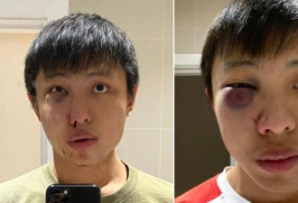 新加坡留学生因新冠疫情在英国伦敦遭围殴