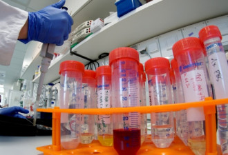新冠疫情暴露加拿大化验室严重短板问题
