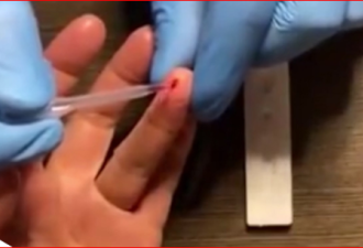 FDA批准 一滴血验抗体 无惧新冠可复工