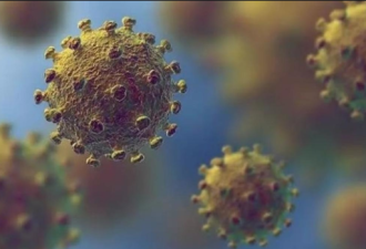 美传染病专家:新冠病毒在美国的传播正在加速