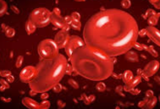 美FDA通过申请 允许使用新冠治愈患者血浆治疗
