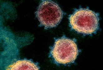 冠状病毒疫情减缓 世卫:比H1N1致命10倍以上