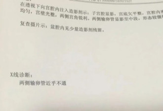 当取卵针戳进我的卵巢时，丈夫在看片取精