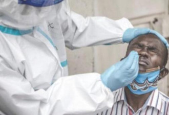 世卫组织：新冠病毒病或将导致非洲19万人死亡