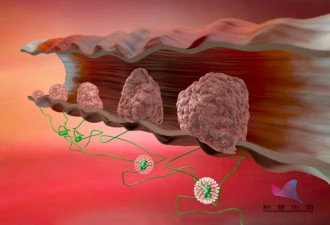 人只要活得够久，就一定会得癌！癌细胞的真相