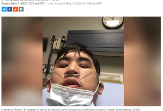 本拿比26岁华人小伙确诊新冠 昏迷近1个月