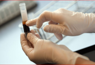科学家对血浆抗体防治谨慎乐观