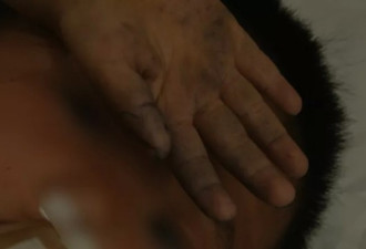 4个男孩路边呕吐，神志不清反复抽搐