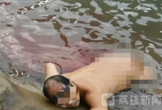 男子江泳时臀部被快艇撕裂，伤情严重