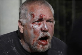 持弓箭瞄准和平示威者 美国白人男子被痛殴