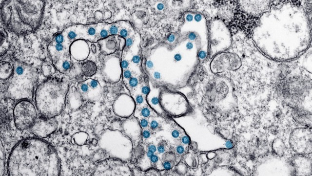 coronavirus coronavirus