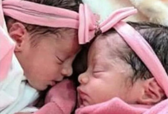 巴西双胞胎女婴遭家犬活活咬死