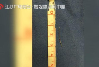 女子喉咙痛以为卡住鱼刺 吞下一个饭团后悲剧了