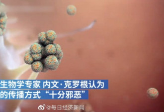 新冠病毒感染细胞显微图像首次公布