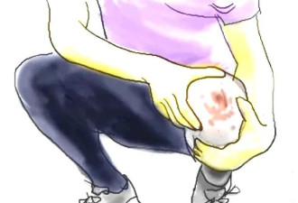 小伙膝盖受伤淤血用针挑脓 感染“超级细菌”