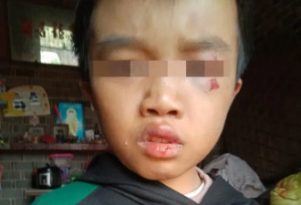 江西12岁男童满身伤痕惨死家中父母被拘