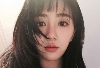 26岁韩国女偶像再度割腕，伤口曝光狰狞吓人