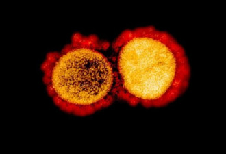印尼发现新冠病毒变异,传染性或高十倍