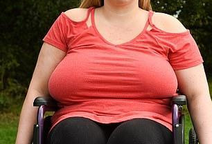 英国前女运动员胸部太大压垮脊柱，坐轮椅4年