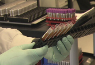 多伦多超过1%的市民已有新冠血清抗体