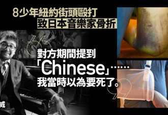 旅美日本音乐家被围殴打惨 因被当成中国人