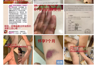 盘点遭家暴明星：黄奕被打成脑震荡