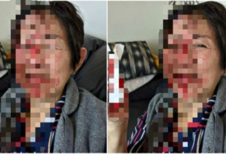 70岁亚裔老妇在家遭陌生女子伏击